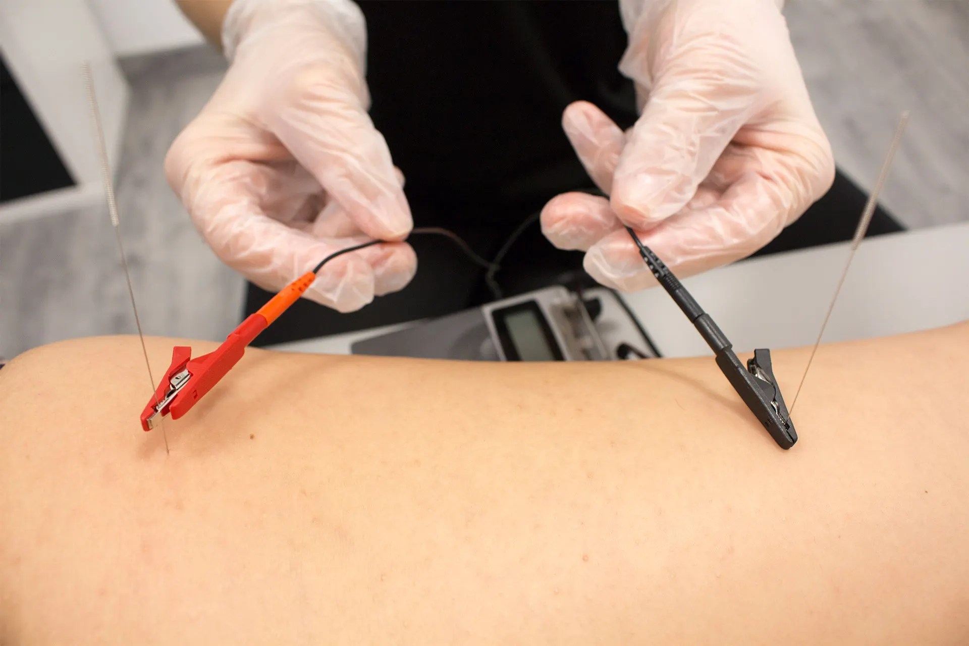 Fisioterapia invasiva